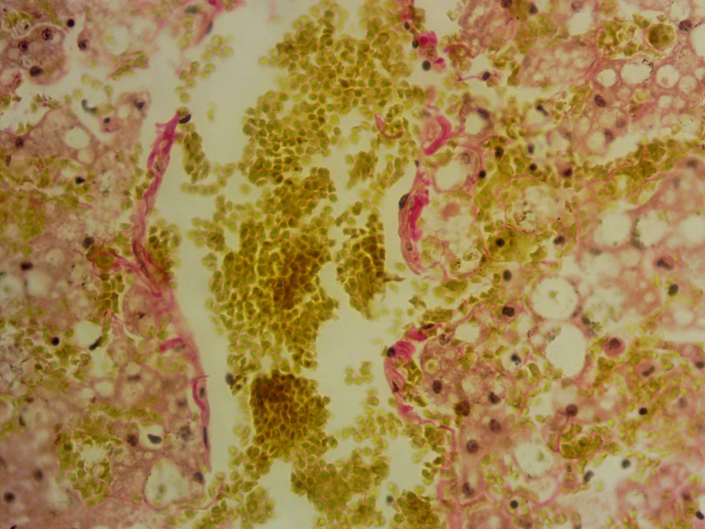 Histological picture of the mink liver with fatty hepatosis