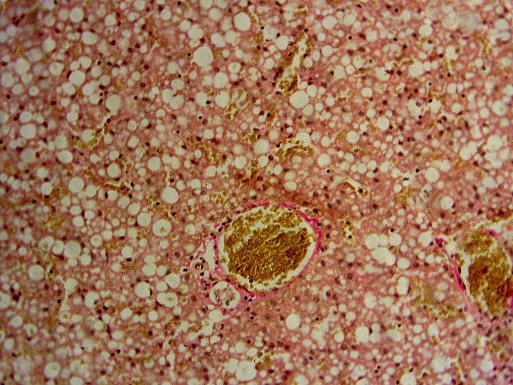 Histological picture of the mink liver with fatty hepatosis