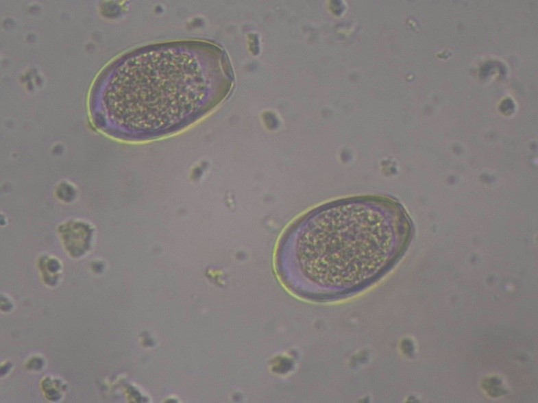 Яйца Dicrocoelium dendriticum из жёлчного пузыря зайца-русака (Lepus europaeus)