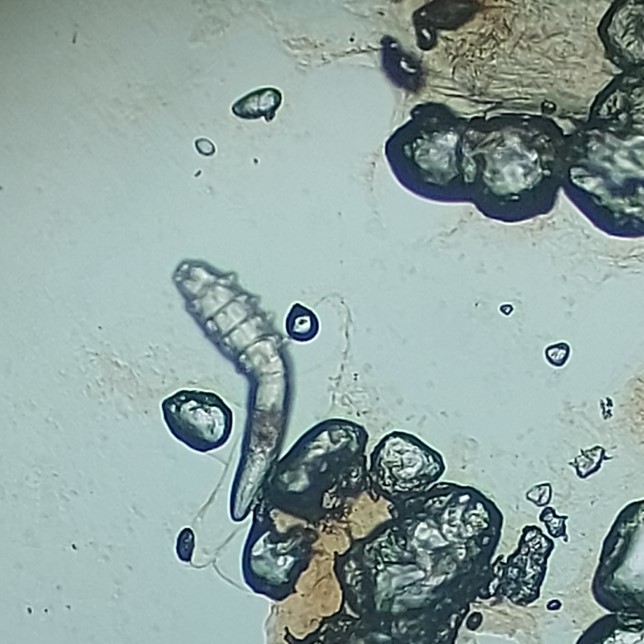 Микрофото Demodex canis