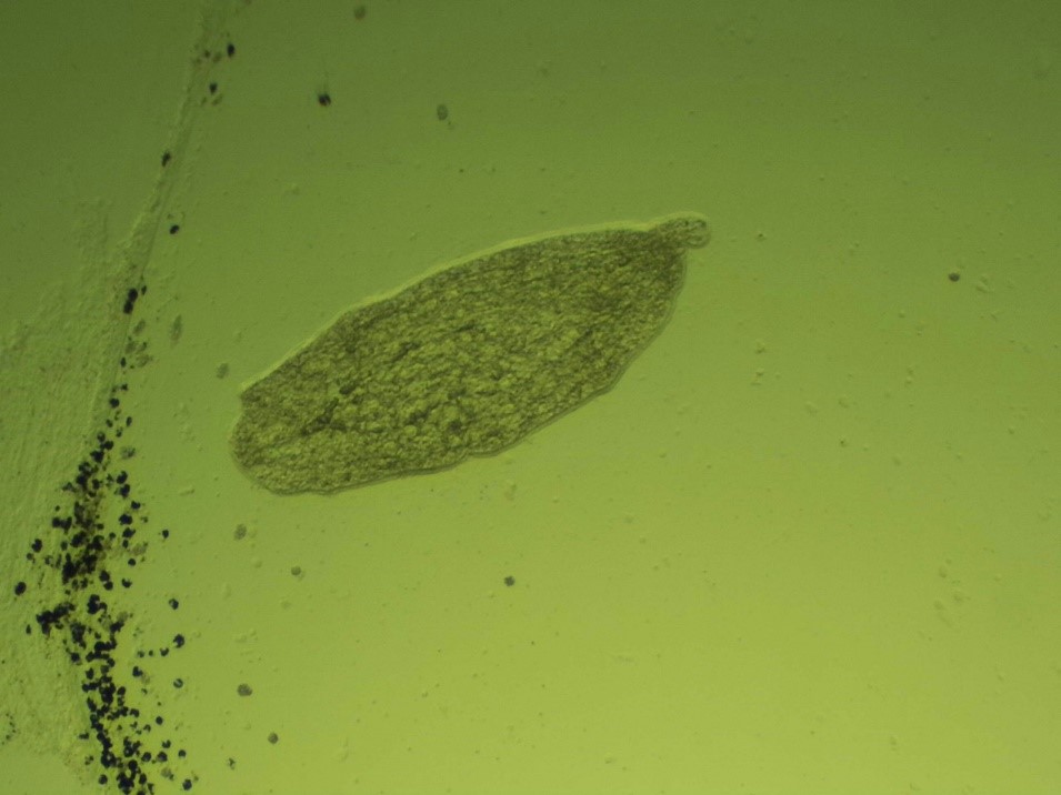 Метацеркарии диплостомид (Diplostomum mergi) в хрусталике глаза у карася  (Carassius carassius)