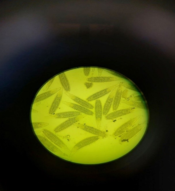  Метацеркарии телядельфусов (Tylodelphys clavata) в стекловидном теле глаза у карпа  (Cyprinus carpio)